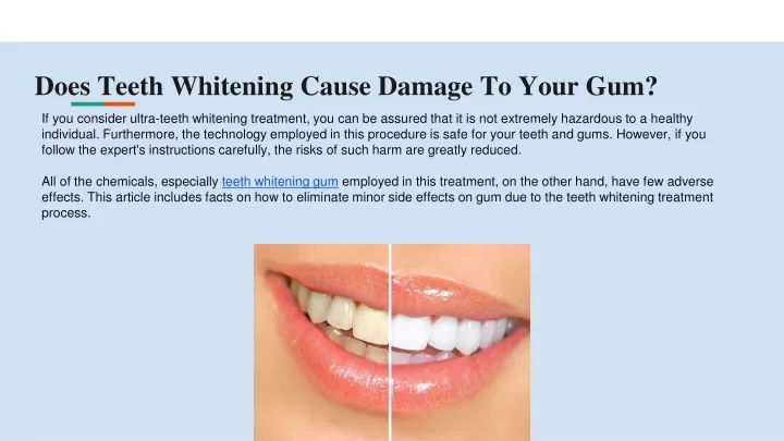 does teeth whitening cause damage to your gum