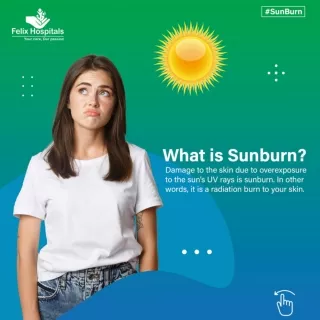 What is Sunburn?