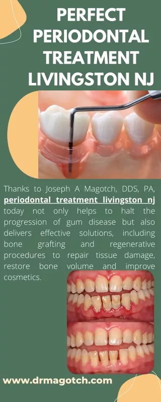 Perfect Periodontal Treatment Livingston NJ