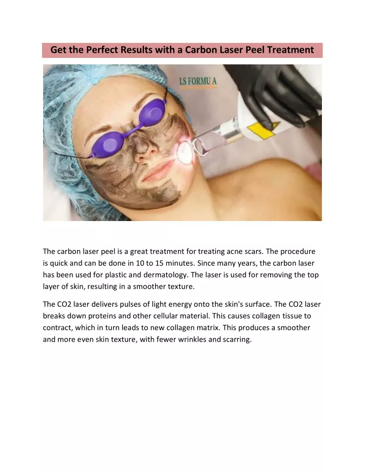 get the perfect results with a carbon laser peel