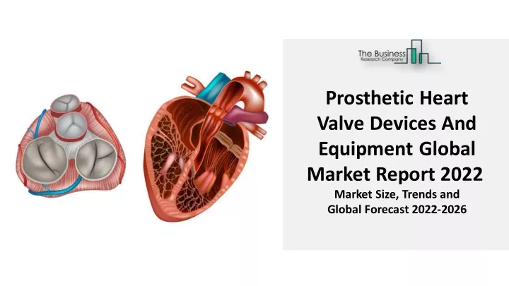 prosthetic heart valve devices and equipment