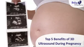 Top 5 Benefits of 3D Ultrasound During Pregnancy