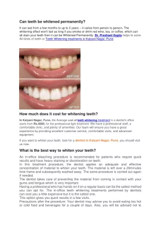 Can-teeth-whitened-be-permanently-Kalyani-Nagar-bracessmiles-Pune