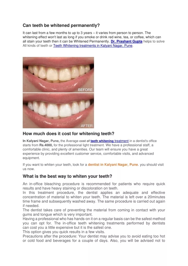 can teeth be whitened permanently