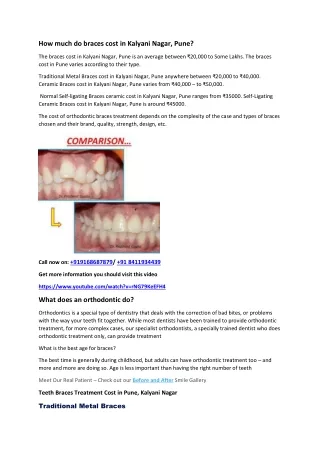 How-much-do-braces-cost-in-Kalyani-Nagar-Orthodontics-In-Pune