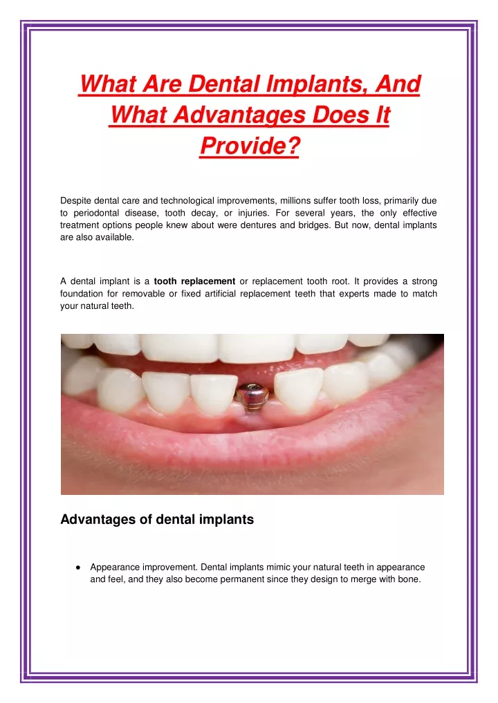 what are dental implants and what advantages does