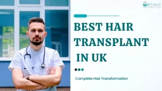Best Hair Transplant In UK