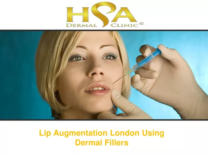 lip augmentation london using dermal fillers