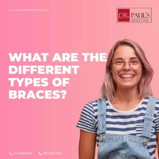 Dental-Braces-In-dubai