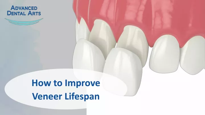 how to improve veneer lifespan
