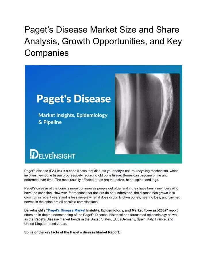 paget s disease market size and share analysis