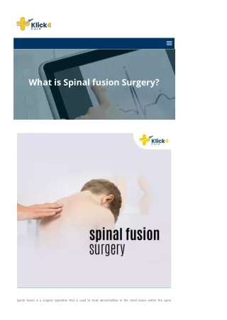 klick4cure-com-what-is-spinal-fusion-surgery-