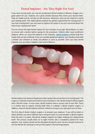dental implants are they right for you