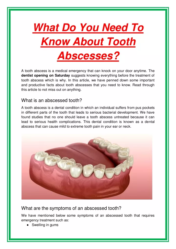 what do you need to know about tooth abscesses