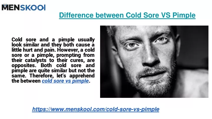 difference between cold sore vs pimple