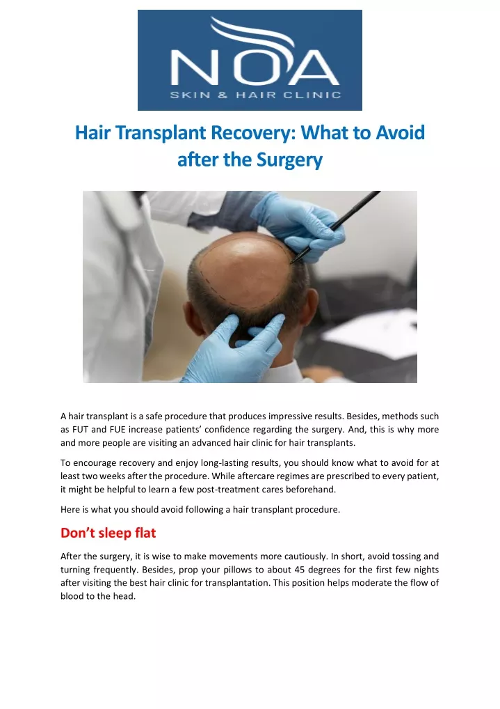 hair transplant recovery what to avoid after