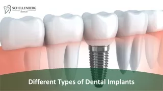 different types of dental implants