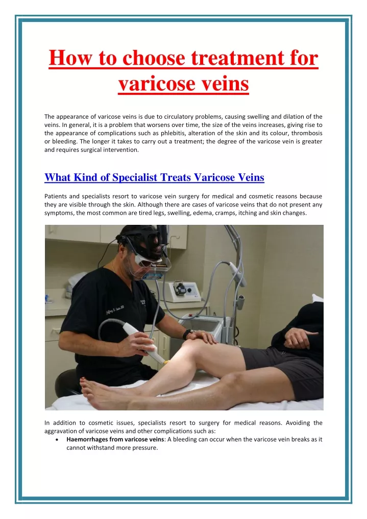 how to choose treatment for varicose veins