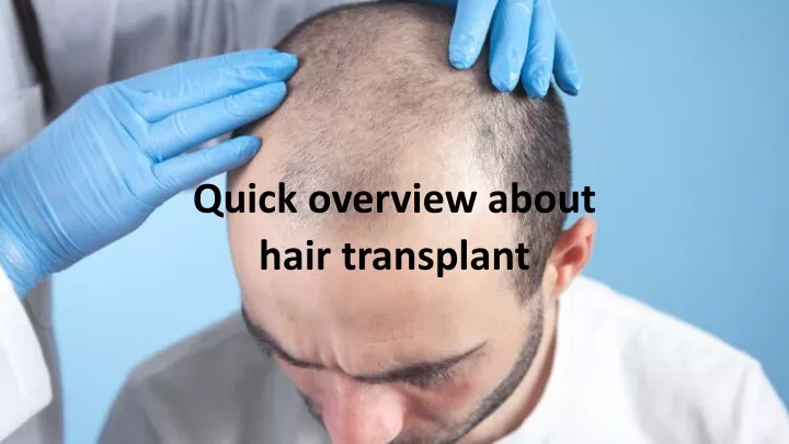 quick overview about hair transplant