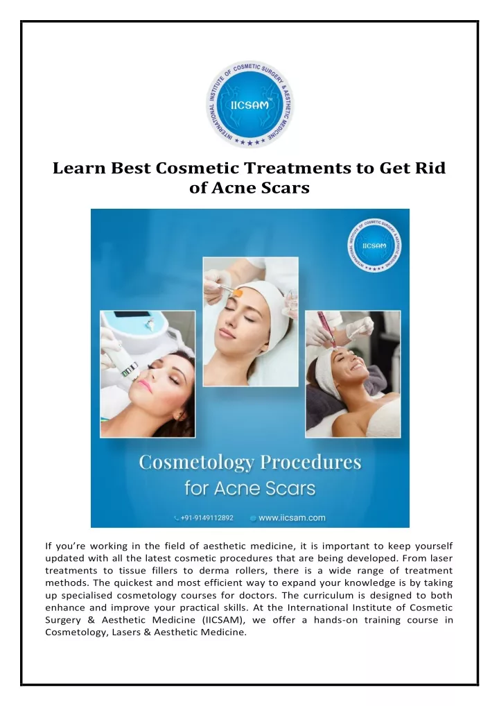 learn best cosmetic treatments to get rid of acne