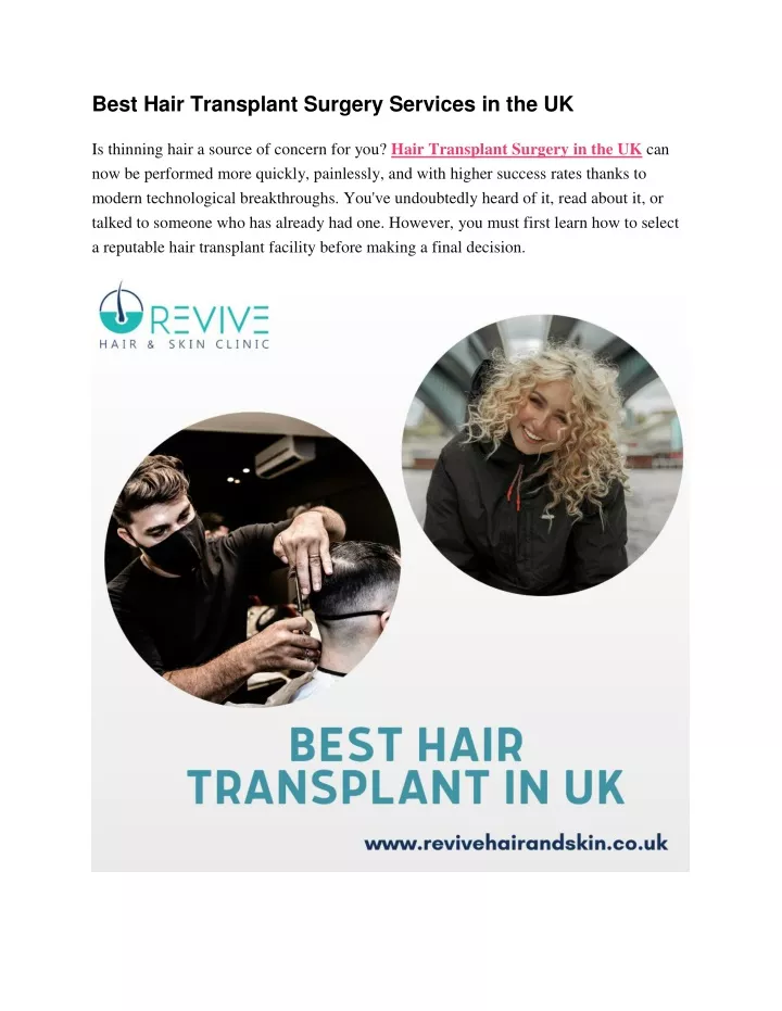 best hair transplant surgery services in the uk