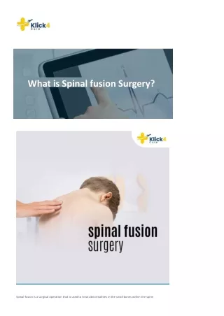 What is Spinal fusion Surgery?