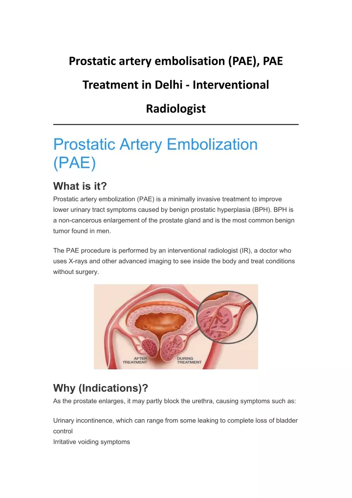 prostatic artery embolisation pae pae
