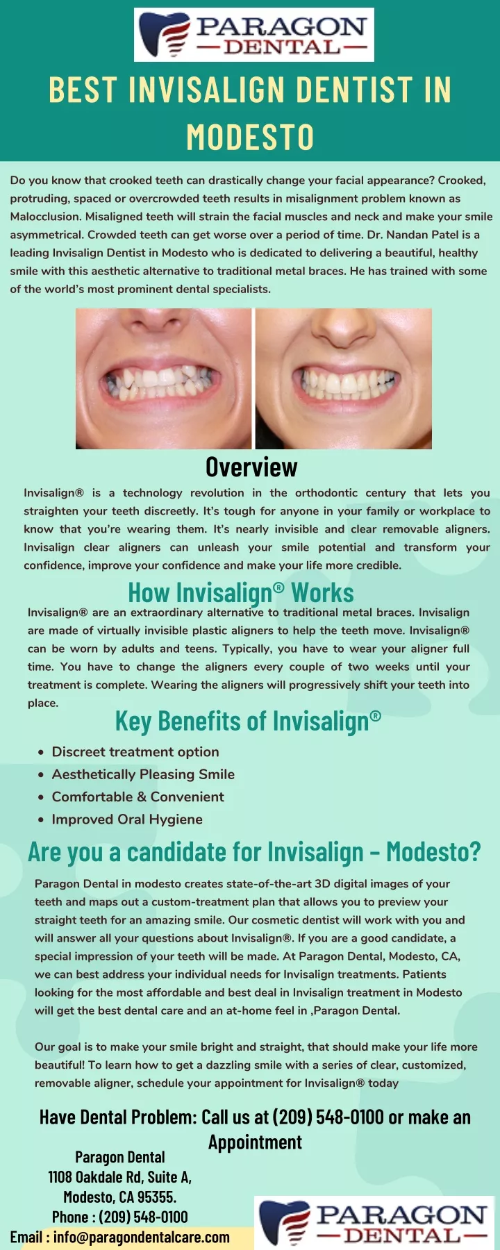 best invisalign dentist in modesto