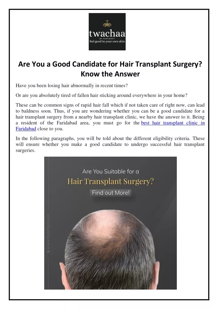 are you a good candidate for hair transplant