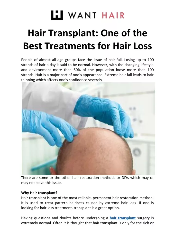 hair transplant one of the best treatments