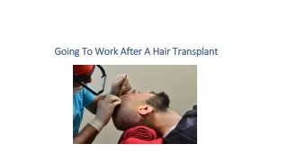 Going To Work After A Hair Transplant