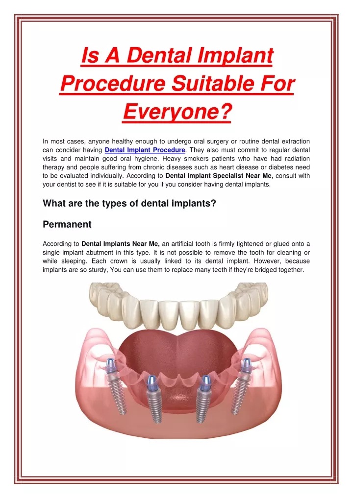 is a dental implant procedure suitable