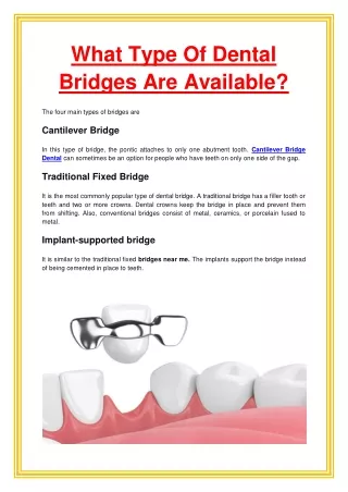 what type of dental bridges are available