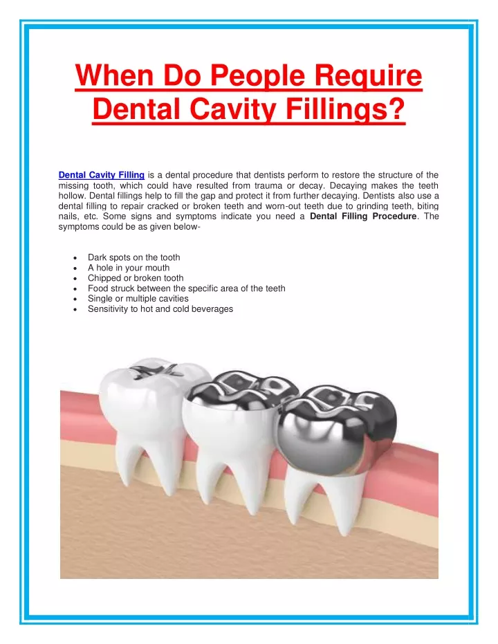 when do people require dental cavity fillings