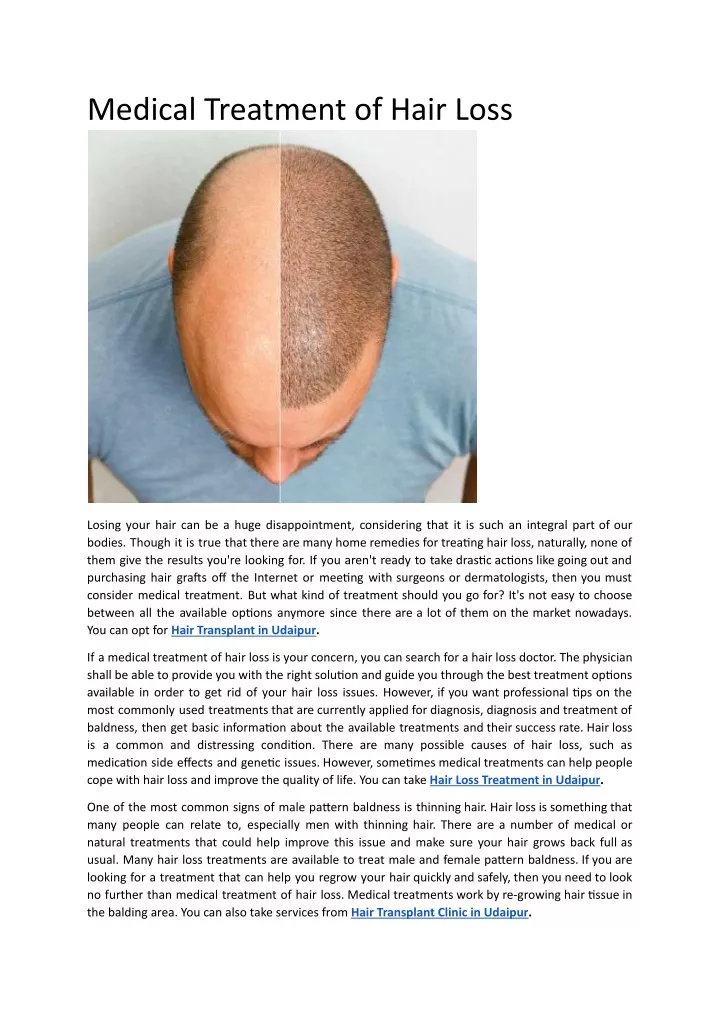 medical treatment of hair loss