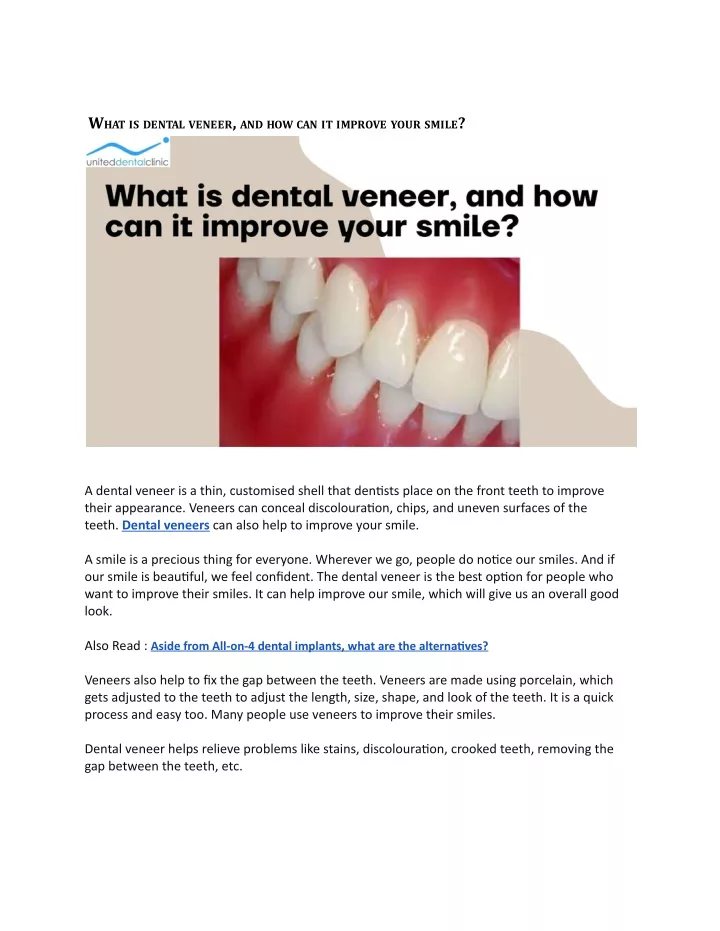 w hat is dental veneer and how can it improve