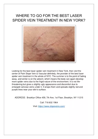 WHERE TO GO FOR THE BEST LASER SPIDER VEIN TREATMENT IN NEW YORK?