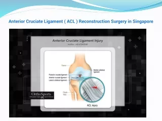 Ligament Reconstruction Surgery in Singapore