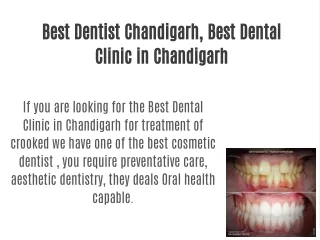 Best Dentist Chandigarh, Best Dental Clinic in Chandigarh