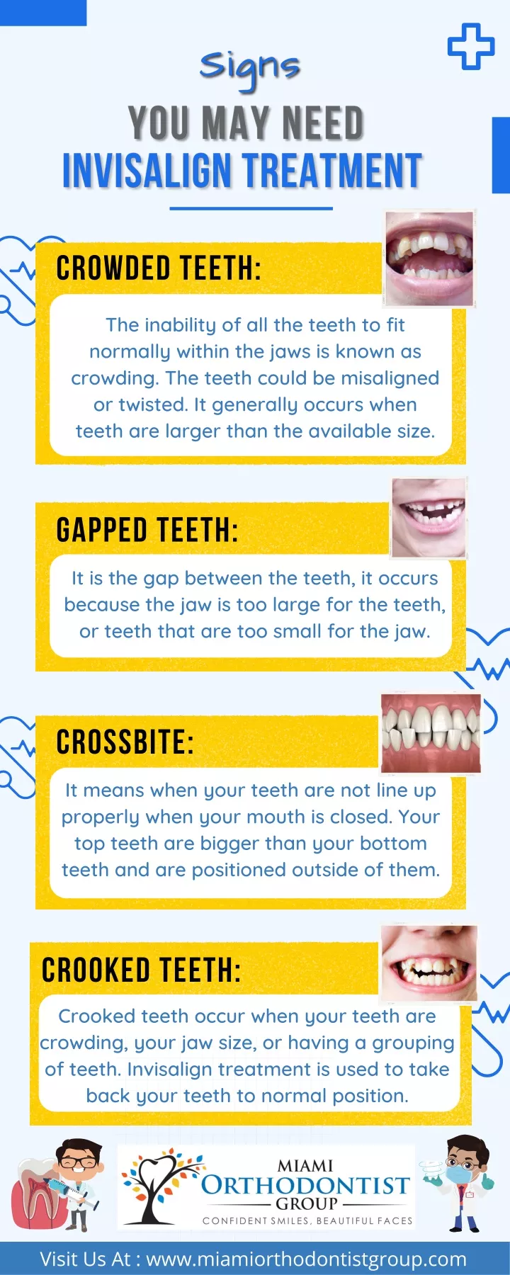 crowded teeth