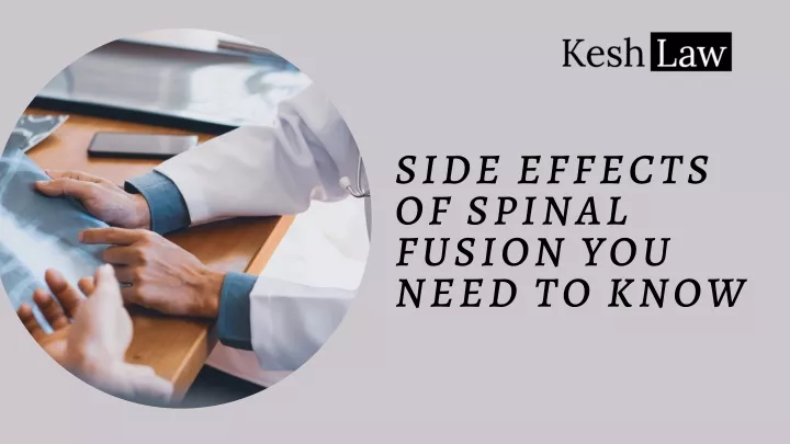 side effects of spinal fusion you need to know