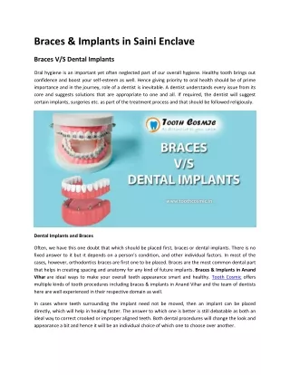 Braces & Implants in Saini Enclave