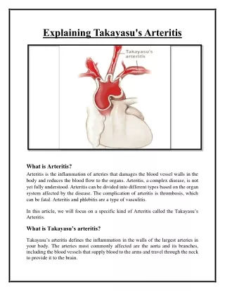 explaining takayasu s arteritis
