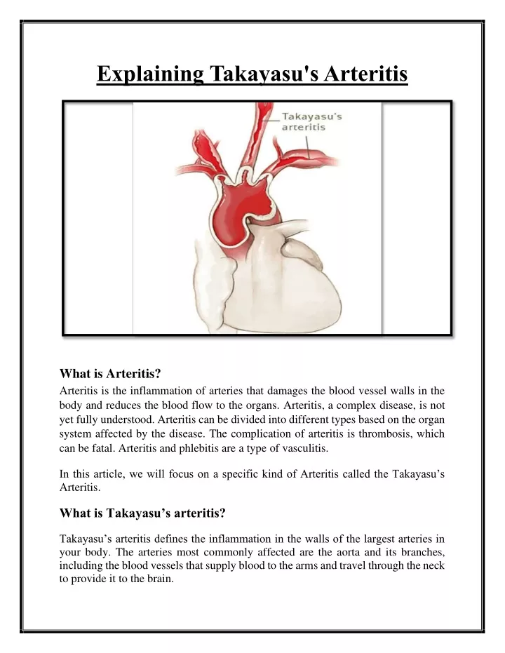 explaining takayasu s arteritis
