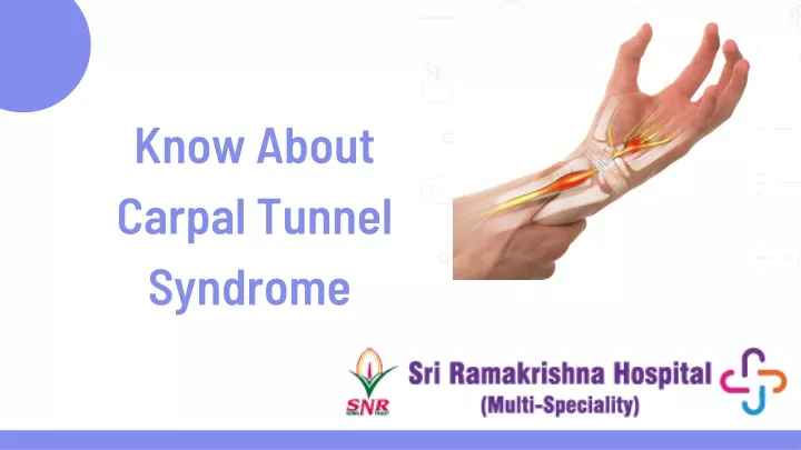 know about carpal tunnel syndrome