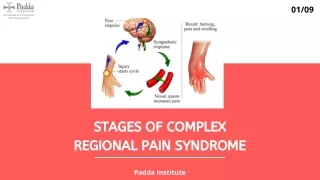 Stages Of Complex Regional Pain Syndrome