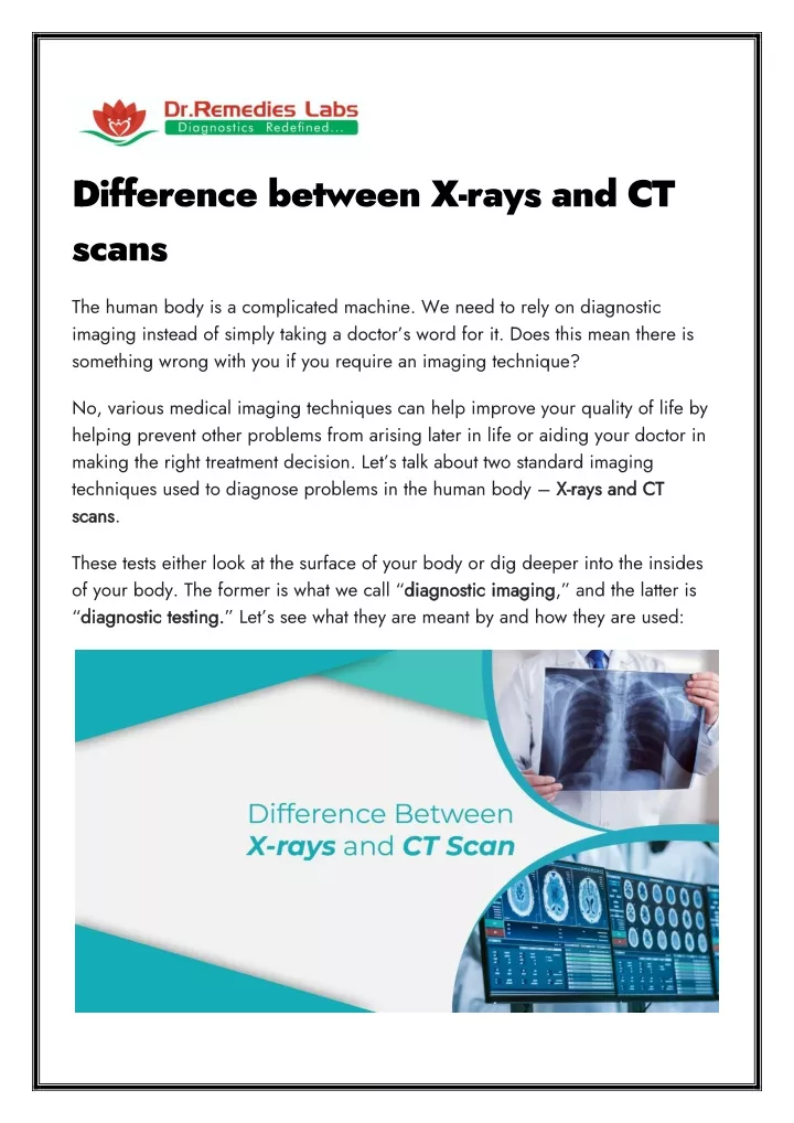 difference between x rays and ct scans