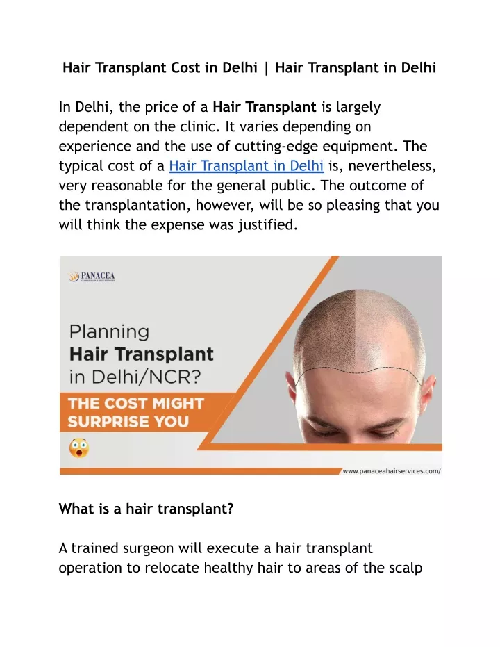 hair transplant cost in delhi hair transplant