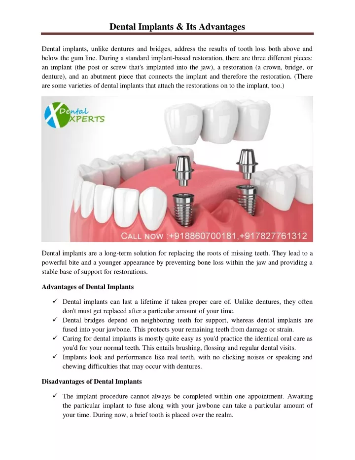 dental implants its advantages