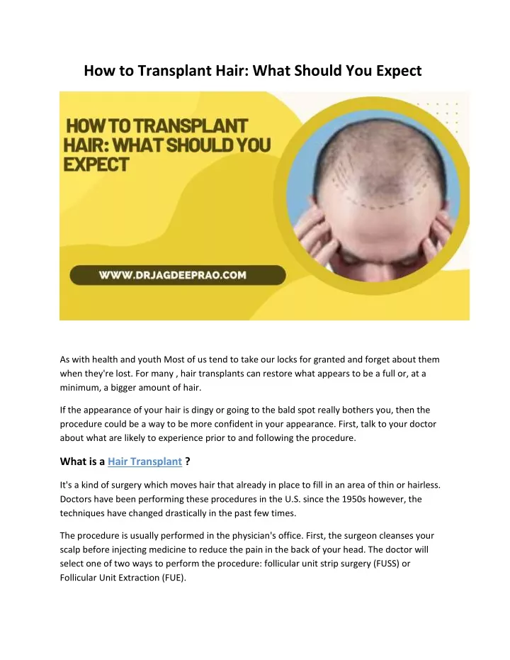 how to transplant hair what should you expect